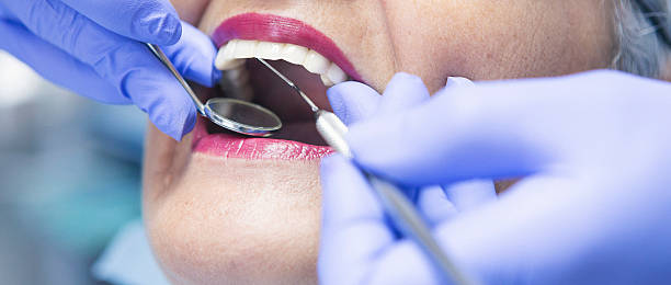 Best Dental Abscess Treatment in Pojoaque, NM